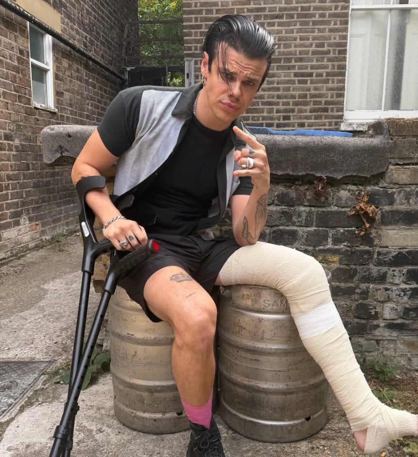 Yungblud for å fullføre tur med brukket bein